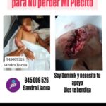 Niño de 2 años resulta gravemente herido tras ser arrastrado por mototaxi