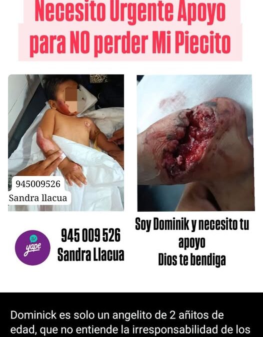 Niño de 2 años resulta gravemente herido tras ser arrastrado por mototaxi